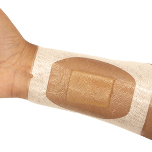 Transparent IV Fixation Dressing with Chlorhexidine Gluconate Pad (CHG)