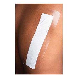 Transparent Island Dressing Wound Care